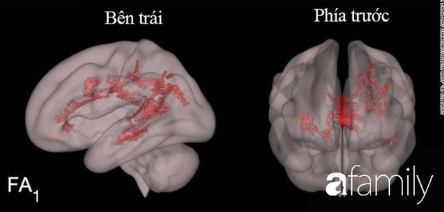 Giảm căng thẳng khi đọc sách