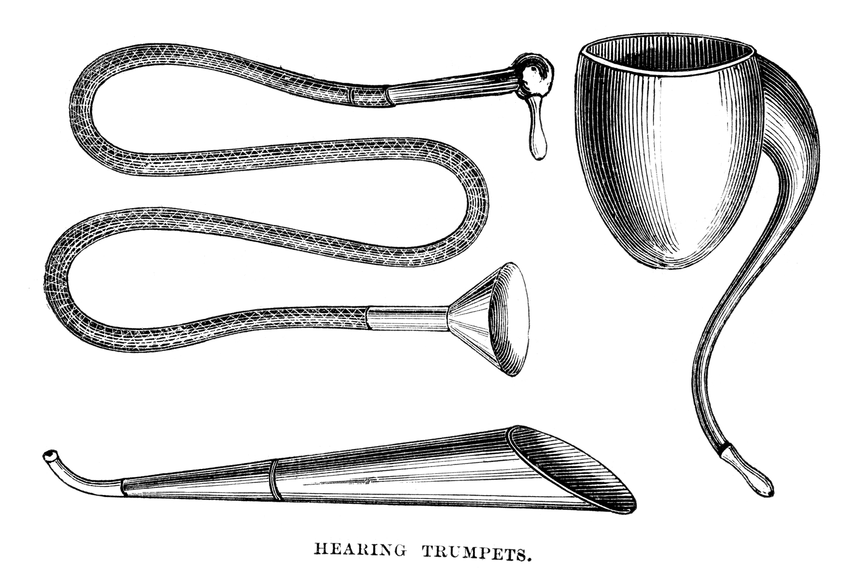 Beethoven mất thính lực