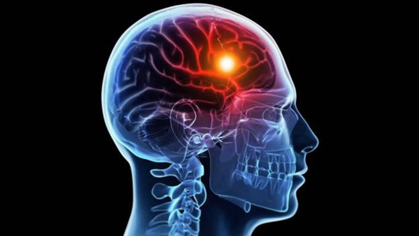 Nguyên nhân và triệu chứng thiếu oxy lên não