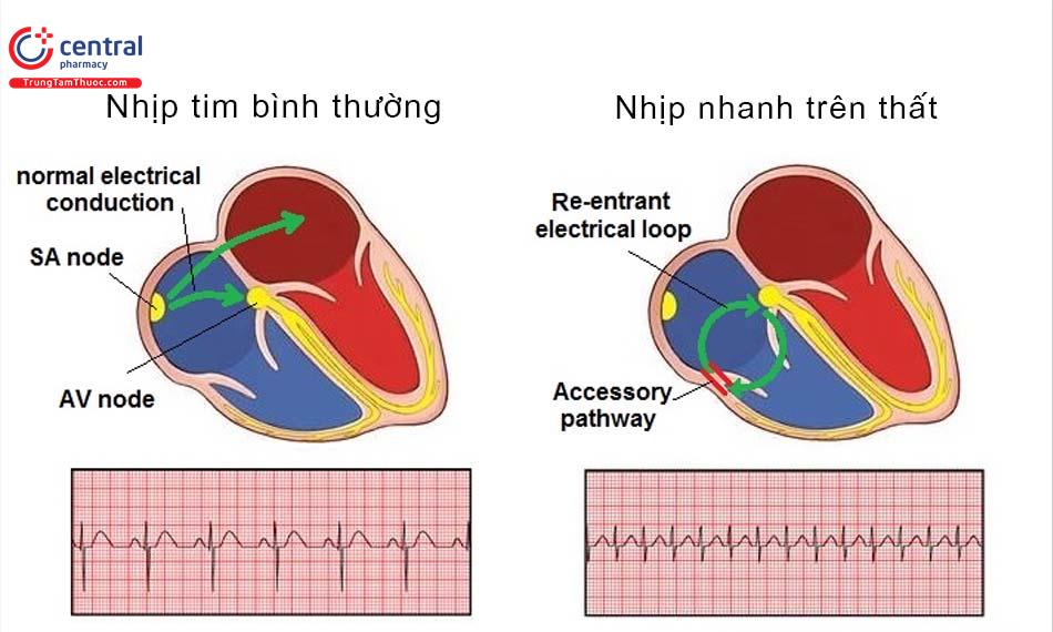 Cơ thể phản ứng với nhịp trống nhanh hơn giai điệu: Sự thật khoa học ít ai biết 6 Nhịp tim phản ứng nhanh với nhịp trống