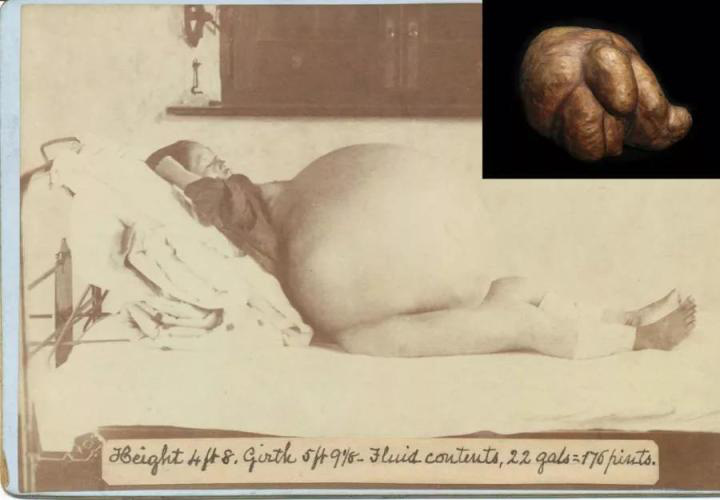 Mẫu vật giải phẫu, não người